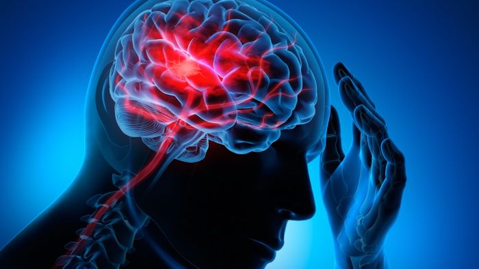 What is brain hemorrhage and can it be fatal?